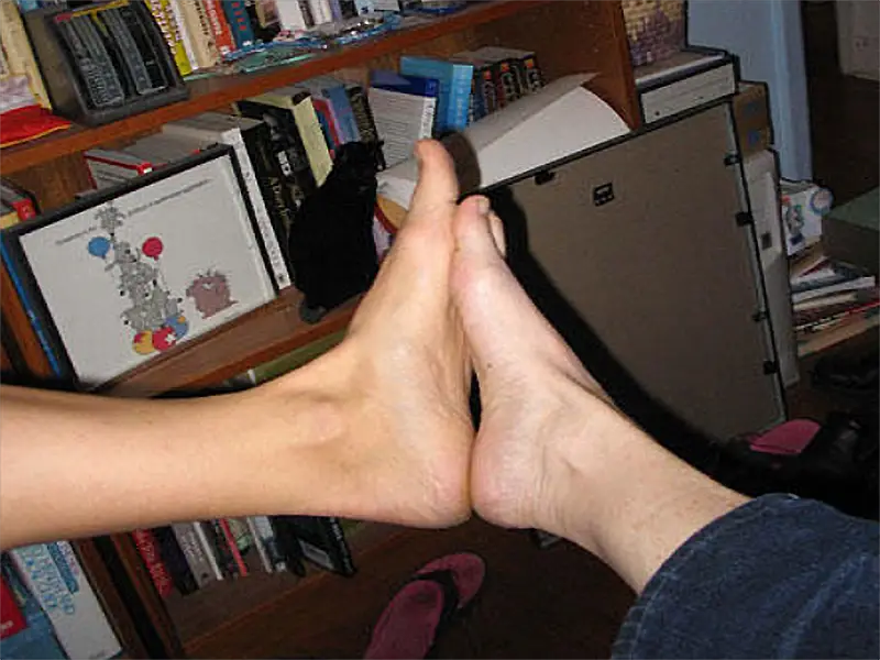 Large feet
