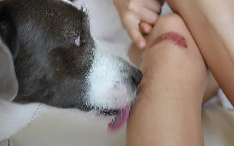 www.akc.org/expert-advice/health/should-dogs-lick-wounds. https://spiritdog...